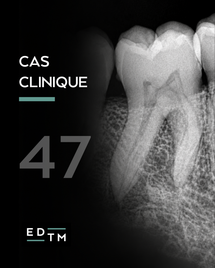 Cas 47 - Dr Benjamin Orlik - Cabinet EDTM