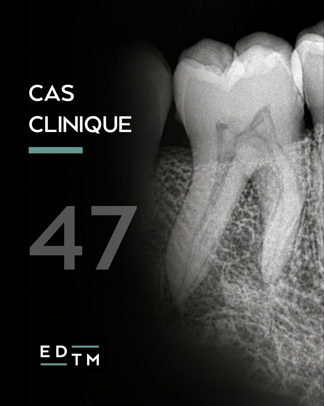 Cas 47 - Dr Benjamin Orlik - Cabinet EDTM