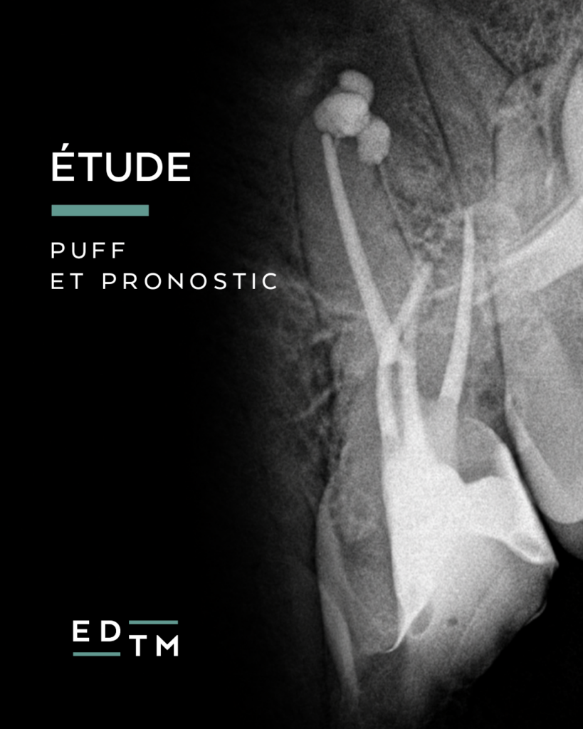 Etude puff et pronostic - dr matteo amar - edtm - cabinet endodontie